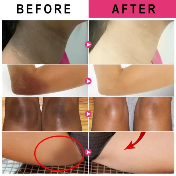 Creme Clareador para Pele Escura: Ilumine suas Áreas Íntimas e Axilas - Image 6